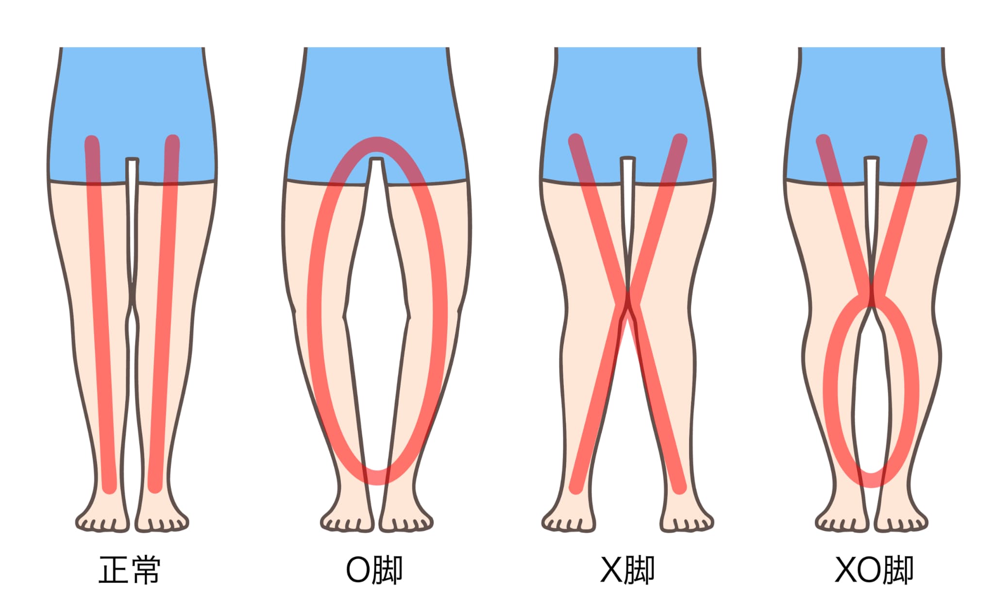 骨格の比較